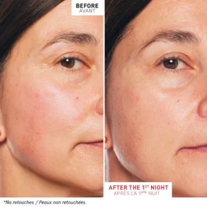 Erborian Skin Therapy Huile Visage Multi-perfectrice 30ml + Trousse Offerte – Image 5